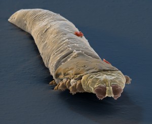This is colorized scanning electron micrograph of Demodex (Demodex folliculorum), tiny parasitic mites that live in the hair follicles of humans and other mammals. A friend got it for me from Eye of Science / Science Source. Gross, huh?